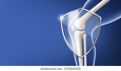 Modelo de articulación de rodilla con icono de escudo de protección. Concepto de seguridad ortopédica de atención médica. Vector ilustración realista