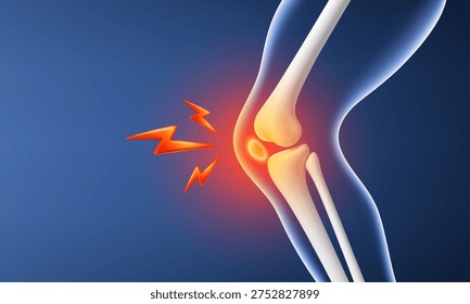 Knee joint pain inflammation concept. Human leg bones with arthritis or injury. Orthopedic medical vector illustration