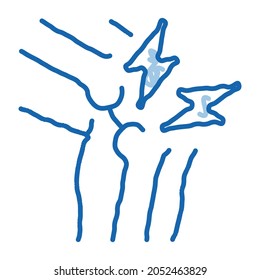 Knee Joint Pain sketch icon vector. Hand drawn blue doodle line art Knee Joint Pain sign. isolated symbol illustration