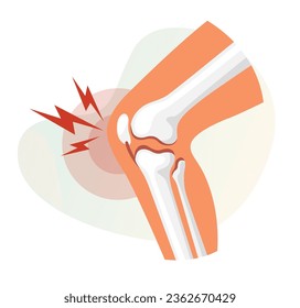 Knee Joint - Pain - Stock Illustration as EPS 10 File