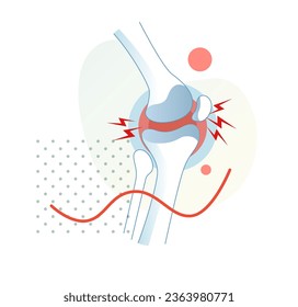 Kniegelenke - Schmerzen - Stockillustration als EPS10-Datei