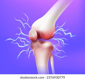 Knee joint pain and tendon problems, side view Inflammatory disease of the knee joint. Realistic 3D vector file.