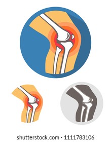 Knee joint pain vector illustration. 