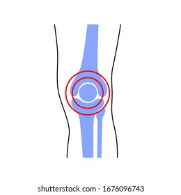 Problema de articulación de rodilla. Dolor en el símbolo de la pierna. Ilustración de concepto plano vectorial. Aislado sobre fondo blanco. Inflamación, reumatismo, concepto de artritis. Cartel médico, educativo y científico
