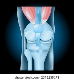 Knee joint with Quadriceps. Front view of human knee with glowing effect. Realistic transparent blue joint on dark background. vector illustration like X-ray image. 