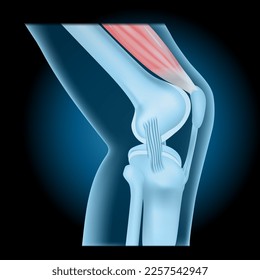 Knee joint with Quadriceps. side view of human knee with glowing effect. Realistic transparent blue joint on dark background. vector illustration like X-ray image