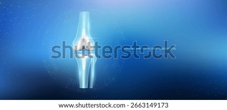 Knee joint replacement total. Prosthetic implant integrated into the leg bone socket. Orthopedic technology artificial joint surgery in a transparent anatomical. Medical health care vector.