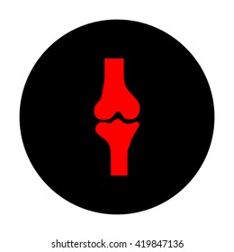 Knee joint sign