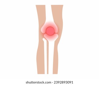 Knee joints pain Arthritis knee joint pain syndrome foot Skeleton Bones Pain Injury