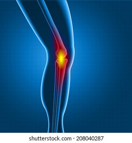 Knee Or Leg X-ray Screen With Red Circle Pain