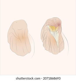 Knee muscles. The image shows the muscle mass in the knee area while bending the knee.