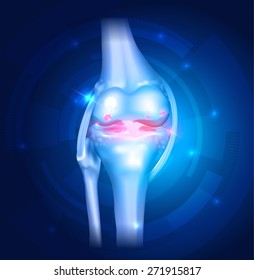 Knee Osteoarthritis abstract blue bright background with lights