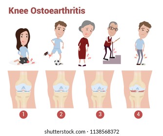 Knee Osteoarthritis Infographic To Explain About Pain, Knee Pain, Joint Pain Which Happen In Adult And Elder Health