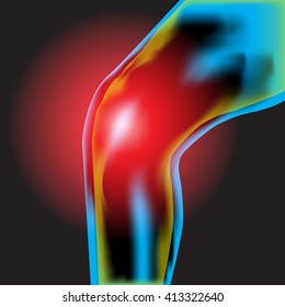 Knee Pain