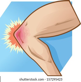 Knee Pain illustration