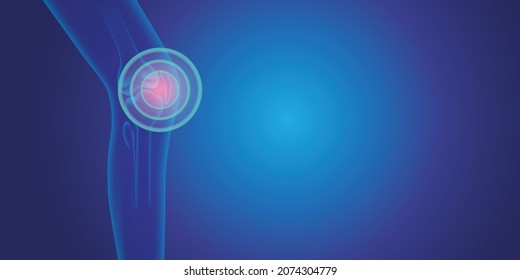 Knee Pain illustration on blue background. Skeleton medical concept.