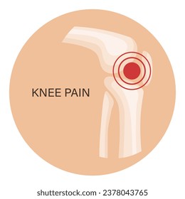 Knee pain, osteoarthritis, rheumatoid arthritis. Anatomy of human bones. Medicine. Illustration, vector