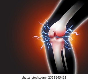 Knee pain and pain throbbing into the bone Inflammatory disease of the knee joint on black background. Realistic 3d vector file.