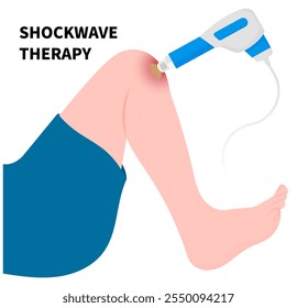 Knee pain treatment by Shockwave therapy to treat muscle repetitive strain tear or overuse injury with Golfer’s elbow syndrome and Morton’s neuroma disease in medical
