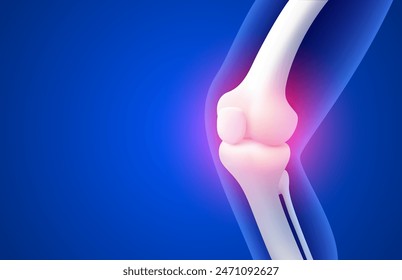 Knieschmerzen, Röntgenaufnahme des Beins, 3D-Visualisierung. Vektorillustration