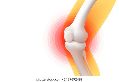 Dolor de rodilla, rayos X de la pierna, visualización 3D. Ilustración vectorial