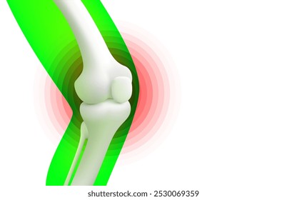 knee pain, X-ray of the leg, 3D visualization. Vector illustration