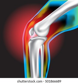 Knee pain ,X-Ray ,Knee Scan