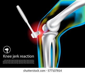 Knee pain ,X-Ray ,Knee Scan