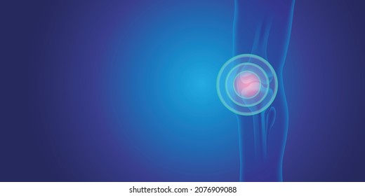 Knee painful. Blue human anatomy of knee. Skeleton x ray on blue background.