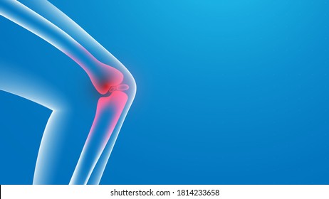 Knee painful. x-ray. Joint pains. 3d Vector illustration