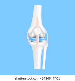 Knee replacement surgery total or implant for treatment relieve arthritis, after joint damaged. Leg bone and cartilage ligament. Innovation medical technology treatment. 3D realistic vector EPS10.