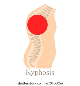 Kyphosis icon. Cartoon illustration of kyphosis vector icon for web isolated on white background