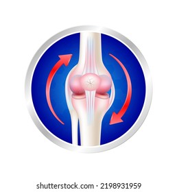 Label aluminum arthritis bone having circular red arrow around. Vitamin and Calcium minerals. logo template for use in product design. Medical food supplement concepts. 3D Realistic Vector EPS10.