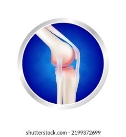 Label aluminum arthritis bone. Leg knee joint side view. Vitamin and Calcium minerals. logo template for use in product design. Medical food supplement concepts. 3D Realistic Vector.