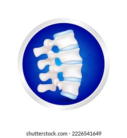 Label aluminum. Backbone disc joint with healthy cartilage. Vitamin and Calcium minerals. logo template for use in product design. Medical food supplement concepts. 3D Realistic Vector.