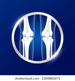 Label aluminum bone healthy. Leg knee joint. Vitamin and Calcium minerals. logo template for use in product design. Medical food supplement concepts. 3D Realistic Vector.