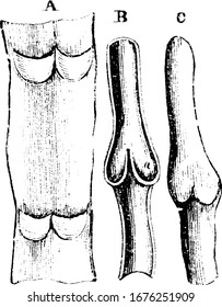 Labels: A, part of a vein laid open and spread out with two pairs of valves; B, longitudinal section of a vein; C, portion of a distended vein, vintage line drawing or engraving illustration.
