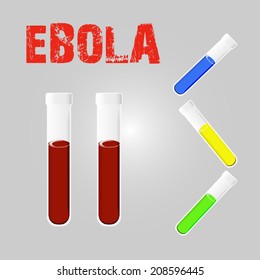 Laboratory concept, test tube