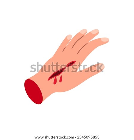 Lacerated wound on the palm. Bleeding cut, injury, accident. Vector medical illustration. 