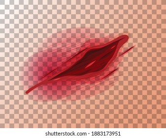 wound clipart