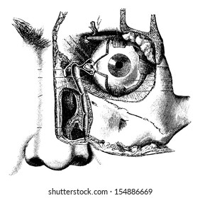 Lacrimal Apparatus, vintage engraved illustration. Usual Medicine Dictionary by Dr Labarthe - 1885