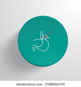 Cirurgia Laparoscópica de Reparação de Hérnia Hiatal Soluções acessíveis para alívio a longo prazo