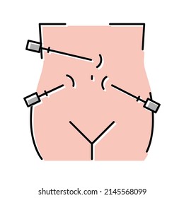 laparoscopy bariatric color icon vector. laparoscopy bariatric sign. isolated symbol illustration
