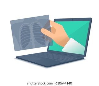 Laptop, doctor's hand holding an x-ray image. Medic through the computer screen examines an xray. Tele, online, remote medicine concept. Vector flat isolated illustration for web design, presentation.