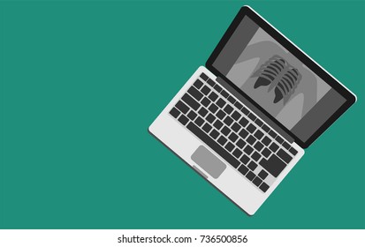 Laptop with view of  chest x-ray isolated on green background. Healthcare and medical concept