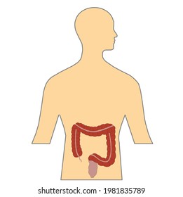 Gran imagen vectorial de color 3D intestinal aislada en blanco para la sensibilización del cuerpo humano y el sistema digestivo y la educación sobre enfermedades de colon.