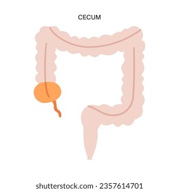 Large intestine anatomical poster. Cecum and appendix, part of the human bowel. Digestive tract examination in gastroenterology clinic. Infographic of colon for education, isolated vector illustration