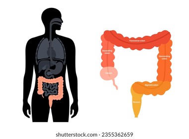 Large intestine anatomical poster. Sections of the human bowel. Digestive tract examination and treatment in gastroenterology clinic. Infographic of colon for education, isolated vector illustration