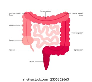 Afiche anatómico intestinal grande. Secciones del intestino humano. Examen y tratamiento del tracto digestivo en la clínica de gastroenterología. Infografía de colon para educación, ilustración vectorial aislada