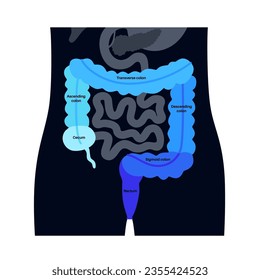 Large intestine anatomical poster. Sections of the human bowel. Digestive tract examination and treatment in gastroenterology clinic. Infographic of colon for education, isolated vector illustration